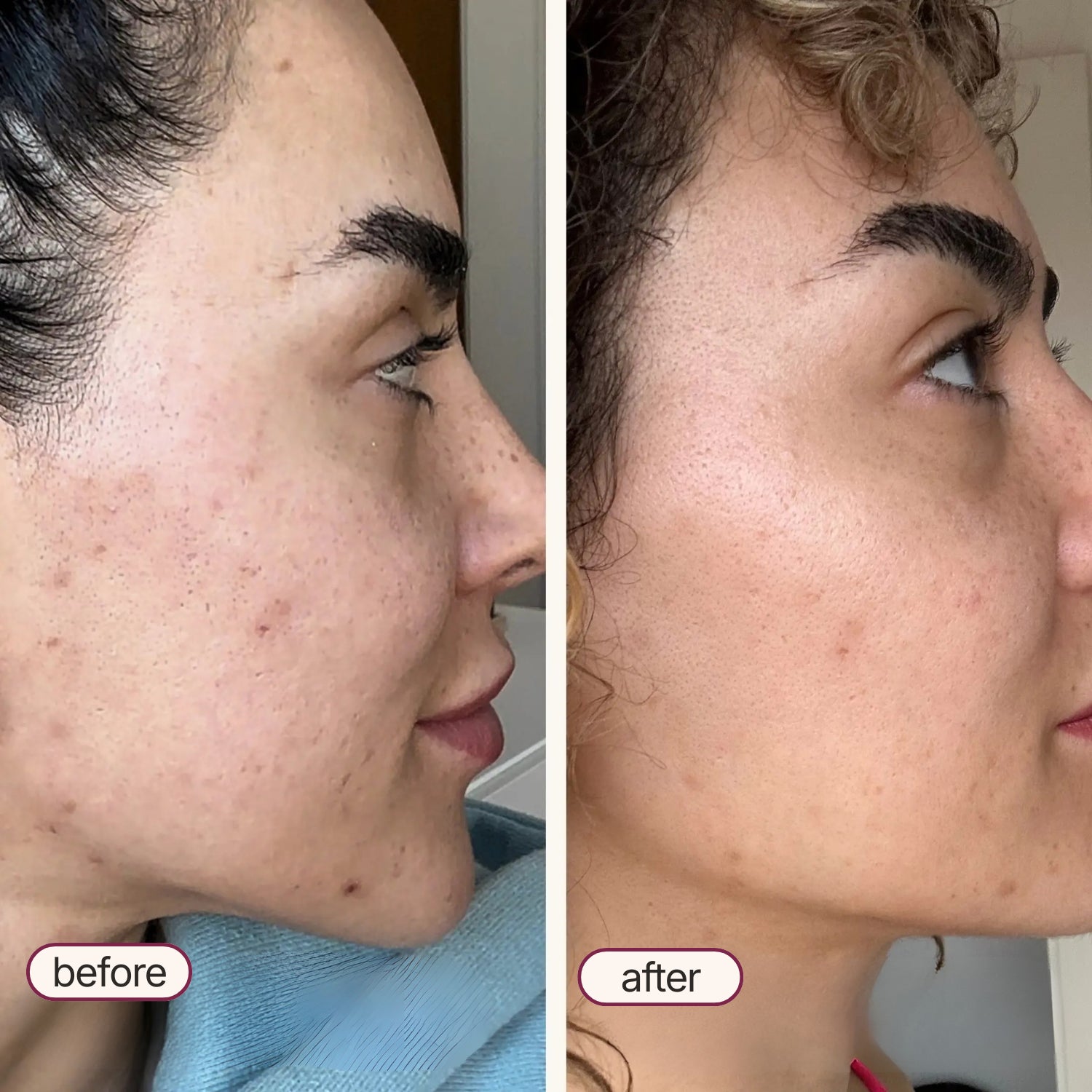 Korean Exfoliant Peel Shot