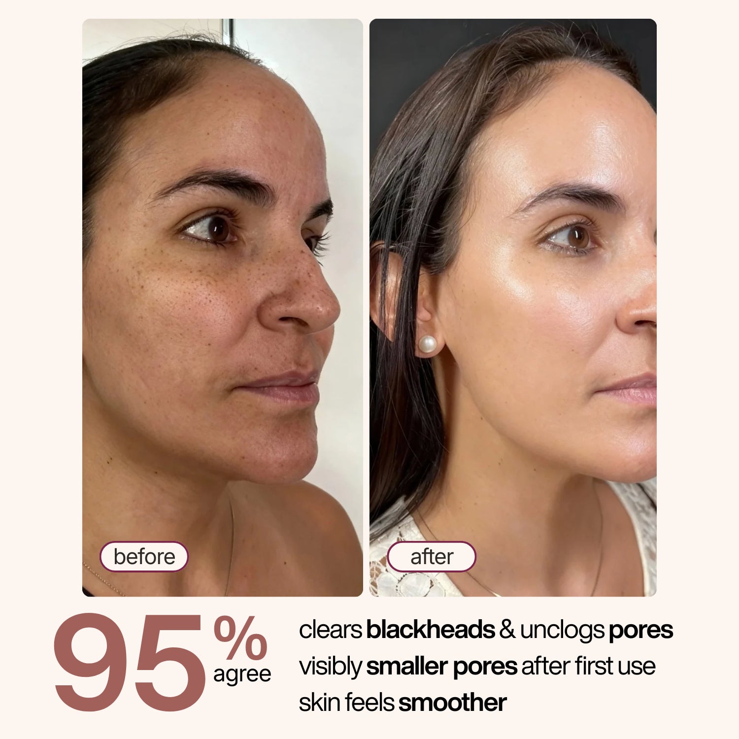 Korean Exfoliant Peel Shot