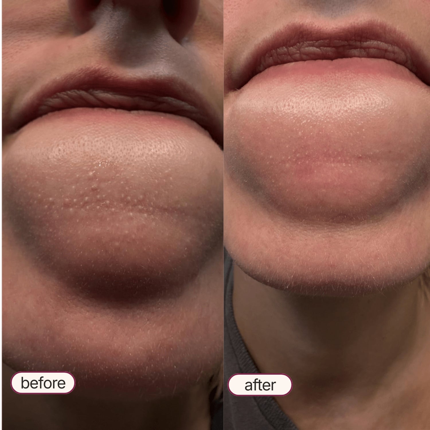 Korean Exfoliant Peel Shot