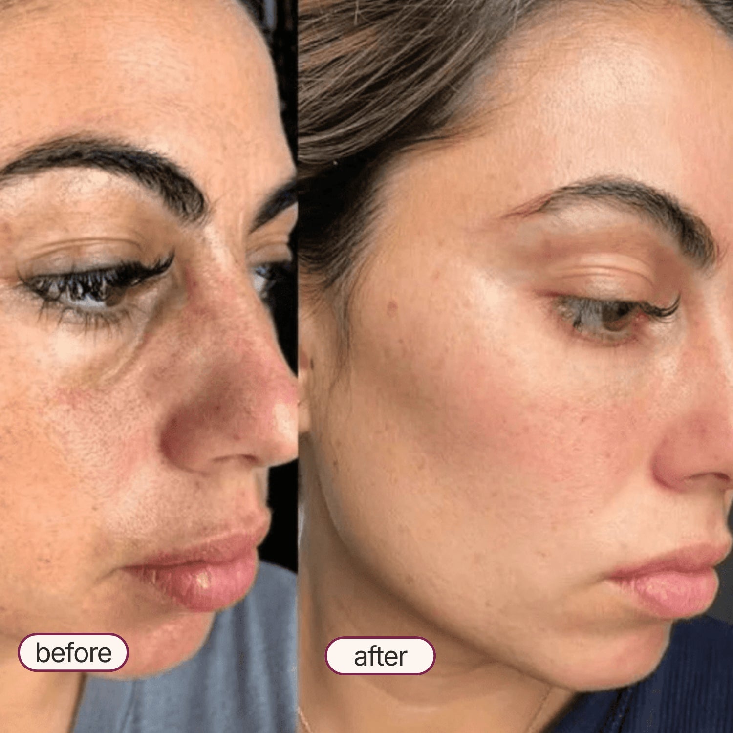 Korean Exfoliant Peel Shot