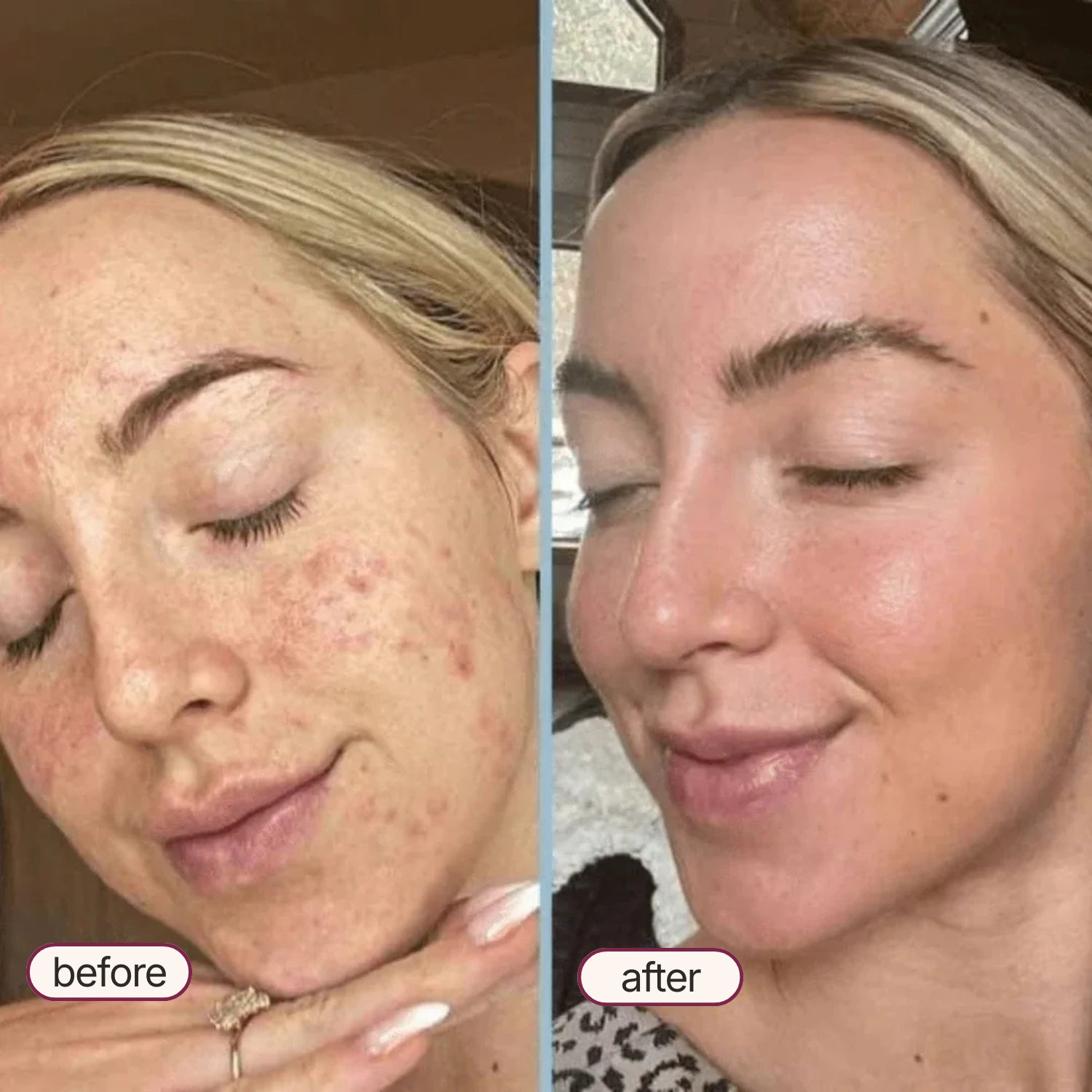 Korean Exfoliant Peel Shot